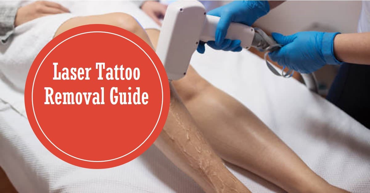 Guide to Laser Tattoo Removal